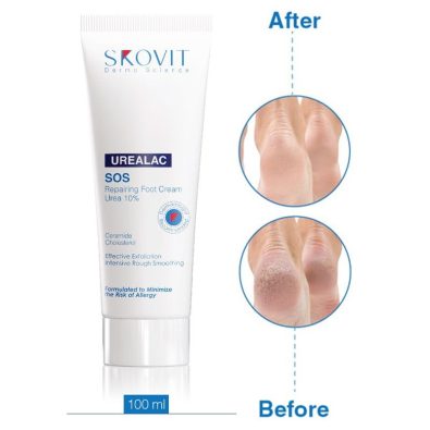 skovit-repairing-cream-urea اوره 10